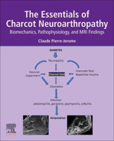 The Essentials of Charcot Neuroarthropathy: Biomechanics, Pathophysiology and MRI Findings 0323993524 Book Cover