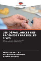 Les Défaillances Des Prothèses Partielles Fixes (French Edition) 6206658562 Book Cover