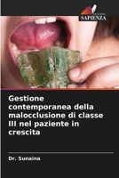 Gestione contemporanea della malocclusione di classe III nel paziente in crescita (Italian Edition) 6208551706 Book Cover
