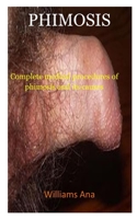 PHIMOSIS: A complete medical procedure of phimosis and its causes B094TJK7ZB Book Cover