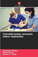 Considerações oclusais sobre implantes (Portuguese Edition) 6208700000 Book Cover