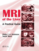 MRI of the Liver: A Practical Guide 0367390752 Book Cover
