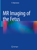 MR Imaging of the Fetus null Book Cover