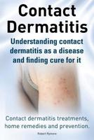 Contact Dermatitis. Contact Dermatitis Treatments, Home Remedies and Prevention. Understanding Contact Dermatitis as a Disease and Finding Cure for It 1910410004 Book Cover