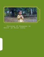 Pictures of Diseases in Child at Rural India 1500889989 Book Cover