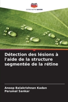Détection des lésions à l'aide de la structure segmentée de la rétine (French Edition) 6208239389 Book Cover