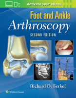 Foot  Ankle Arthroscopy 0781783410 Book Cover