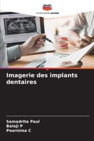 Imagerie des implants dentaires (French Edition) 6208558670 Book Cover