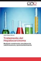 Tratamiento del Hepatocarcinoma 3848454874 Book Cover