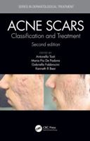 Acne Scars: Classification and Treatment 036738471X Book Cover