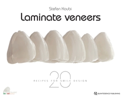 Laminate Veneers (20 Recipes for Smile Design) 2366150555 Book Cover