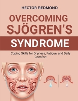 Overcoming Sjögren’s Syndrome: Coping Skills for Dryness, Fatigue, and Daily Comfort B0FZG35YJP Book Cover