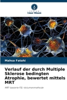 Verlauf der durch Multiple Sklerose bedingten Atrophie, bewertet mittels MRT (German Edition) 6209841384 Book Cover