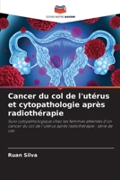 Cancer du col de l'utérus et cytopathologie après radiothérapie (French Edition) 6207740963 Book Cover