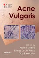 Acne Vulgaris 1841847070 Book Cover