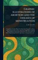 Graphic Illustrations of Abortion and the Diseases of Menstruation 1023439654 Book Cover