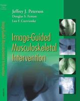 Image-Guided Musculoskeletal Intervention 1416029052 Book Cover