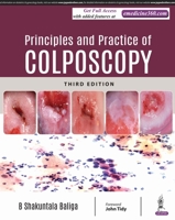 Principles and Practice of Colposcopy 9352701585 Book Cover