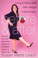 Before & After, Revised Edition: Living and Eating Well After Weight-Loss Surgery