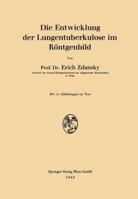 Die Entwicklung Der Lungentuberkulose Im Rontgenbild 3211801278 Book Cover