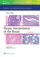 Biopsy Interpretation of the Breast (Biopsy Interpretation Series) 0781791464 Book Cover
