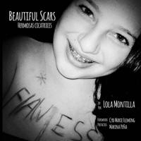 Beautiful Scars Hermosas Cicatrices 1499360789 Book Cover