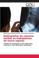 Radiografías de columna lumbar en trabajadores de nuevo ingreso (Spanish Edition) 6200038791 Book Cover