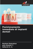 Posizionamento immediato di impianti dentali (Italian Edition) 6208299829 Book Cover