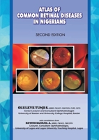 The Atlas of Retinal Diseases in Nigerians 9789212089 Book Cover