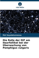 Die Rolle der DIF am Haarfollikel bei der Überwachung von Pemphigus vulgaris (German Edition) 6207860578 Book Cover
