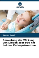 Bewertung der Wirkung von Diodenlaser 980 nm bei der Kariesprävention (German Edition) 6207555953 Book Cover