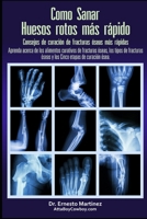 Como curar huesos rotos más rápido. Consejos para curar fracturas de huesos: Aprenda sobre los alimentos para la curación de fracturas, los tipos de ... (Health and Wellness) 1646350189 Book Cover