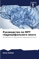 Руководство по МРТ гидроцефального мозга: Руководство по нарушенной гидромеханике мозга 6204159445 Book Cover