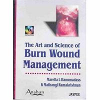 The Art & Science of Burn Wound Management B01N6WLAMH Book Cover