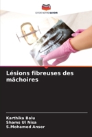 Lésions fibreuses des mâchoires (French Edition) 3330511532 Book Cover
