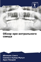 Обзор оро-антрального свища 6204518739 Book Cover