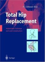 Total Hip Replacement: Implantation Technique and Local Complications 3540438769 Book Cover