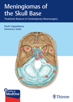 Meningiomas of the Skull Base: Treatment Nuances in Contemporary Neurosurgery 3132412864 Book Cover