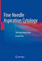 Fine Needle Aspiration Cytology : 100 Interesting Cases 9811397716 Book Cover