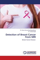Detection of Breast Cancer from MRI 6202674776 Book Cover