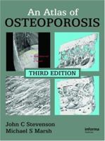 Atlas of Osteoporosis (Encyclopedia of Visual Medicine) 0367452812 Book Cover