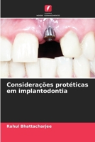 Considerações protéticas em implantodontia (Portuguese Edition) 6207989856 Book Cover