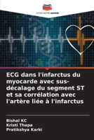 ECG dans l'infarctus du myocarde avec sus-décalage du segment ST et sa corrélation avec l'artère liée à l'infarctus (French Edition) 6207611659 Book Cover