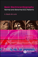 Basic Electrocardiography: Normal and Abnormal ECG Patterns 1405175702 Book Cover