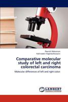 Comparative molecular study of left and right colorectal carcinoma: Molecular differences of left and right colon 3848428806 Book Cover