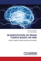 Segmentation of Brain Tumor Based on MRI 620255746X Book Cover