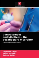 Contratempos endodônticos - Um desafio para o cérebro: Contratempos Endodônticos 6203627976 Book Cover