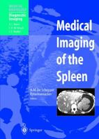 Medical Imaging of the Spleen (Medical Radiology / Diagnostic Imaging) 3540655352 Book Cover