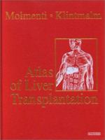 Atlas of Liver Transplantation 0721695515 Book Cover