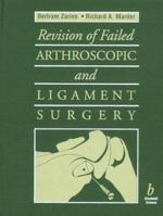 Revision of Failed Arthroscopic and Ligament Surgery 0865424373 Book Cover